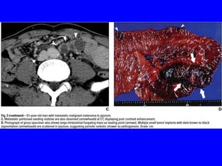 Git j club secondaries.