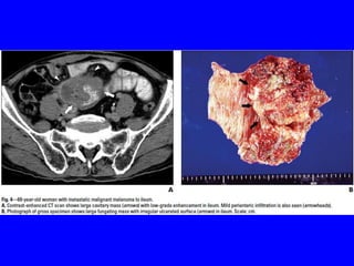 Git j club secondaries.