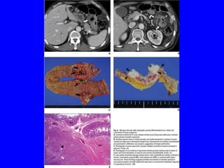 Git j club secondaries.