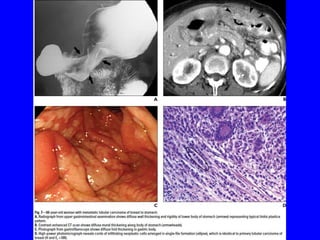 Git j club secondaries.