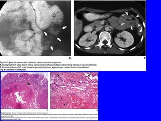 Git j club secondaries.