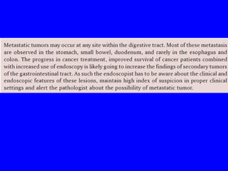 Git j club secondaries.