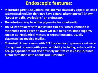 Endoscopic features:
• Metastatic gastric &duodenal melanomas classically appear as small
submucosal nodules that may have central ulceration well-known
“target or bull’s-eye lesions” on endoscopy.
• These lesions may be either pigmented or amelanotic.
• The SI involvement with metastatic tumors is more common in
melanoma than upper or lower GIT due to its rich blood supply&
appear as intraluminal masses or serosal implants, usually
diagnosed on imaging studies.
• Metastatic breast cancer with GIT involvement represents evidence
of a systemic disease,with great variability, including lesions with a
benign appearance but also diffusely infiltrative lesions&localized
tumor formation with nodules/or ulceration.
 