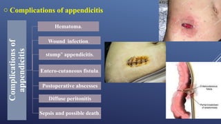Comprehensive Overview of the Gastrointestinal System: Appendix ...