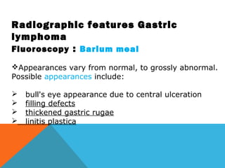 Radiographic features Gastric
lymphoma
Fluoroscopy : Barium meal
Appearances vary from normal, to grossly abnormal.
Possible appearances include:
 bull's eye appearance due to central ulceration
 filling defects
 thickened gastric rugae
 linitis plastica
 