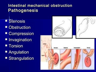 Pathophysiology of digestion. Violation of digestion in a stomach and ...