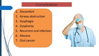 Complication
1. Discomfort
2. Airway obstruction
3. Dysphagia
4. Dysphonia
5. Recurrent oral infection
6. Abscess
7. Oral cancer
 