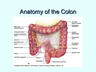 Anatomy of the ColonAnatomy of the Colon
 