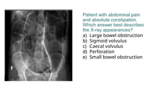 Absolute Constipation Radiology GIT QUIZ Questions without answers..pptx