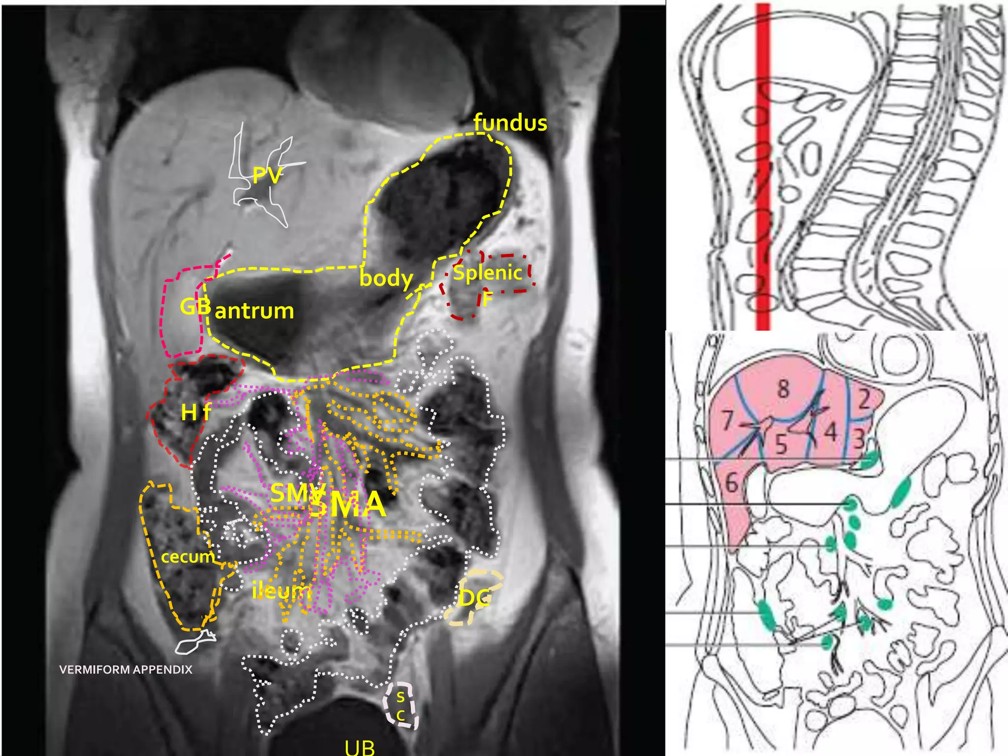 fundus

                     PV



                             body     Splenic
                GB antrum                F




                Hf


                       SMV
                            SMA
             cecum
                     ileum            DC

VERMIFORM APPENDIX

                                  S
                                  C
 