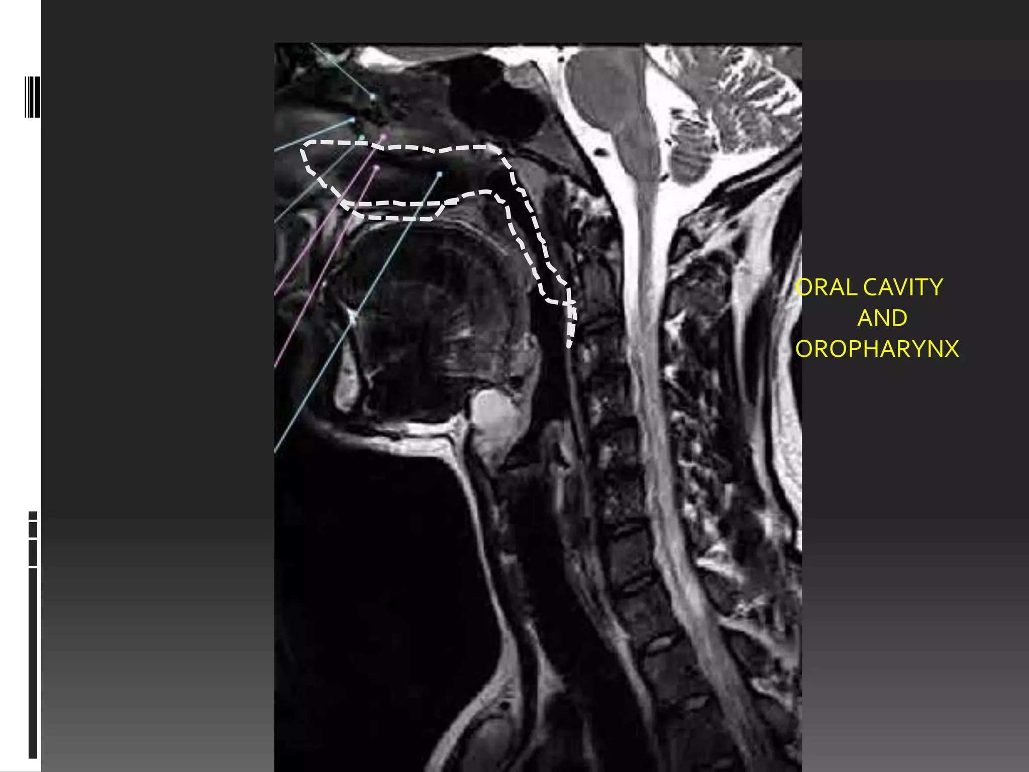 ORAL CAVITY
    AND
OROPHARYNX
 