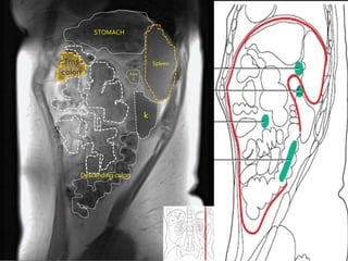 STOMACH



 Trns                            Spleen
colon                  PAN
                        C




                             k




    Descending colon
 