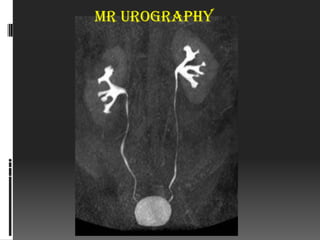 MR urography
 