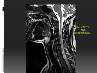 ORAL CAVITY
    AND
OROPHARYNX
 