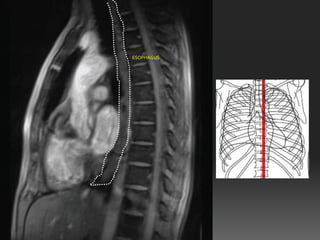 ESOPHAGUS
 