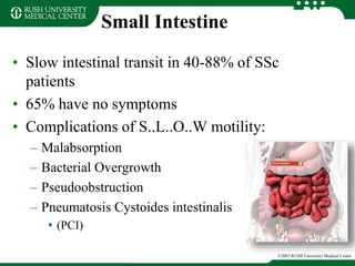 Small Intestine
• Slow intestinal transit in 40-88% of SSc
patients
• 65% have no symptoms
• Complications of S..L..O..W motility:
– Malabsorption
– Bacterial Overgrowth
– Pseudoobstruction
– Pneumatosis Cystoides intestinalis
• (PCI)
©2003 RUSH University Medical Center
 