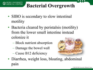 Bacterial Overgrowth
• SIBO is secondary to slow intestinal
motility
• Bacteria cleared by peristalsis (motility)
from the lower small intestine instead
colonize it
– Block nutrient absorption
– Damage the bowel wall
– Cause B12 deficiency
• Diarrhea, weight loss, bloating, abdominal
pain
©2003 RUSH University Medical Center
 