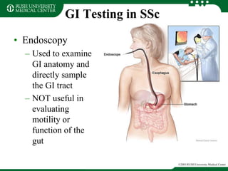 GI Testing in SSc
• Endoscopy
– Used to examine
GI anatomy and
directly sample
the GI tract
– NOT useful in
evaluating
motility or
function of the
gut
©2003 RUSH University Medical Center
 