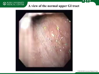 A view of the normal upper GI tract
©2003 RUSH University Medical Center
 