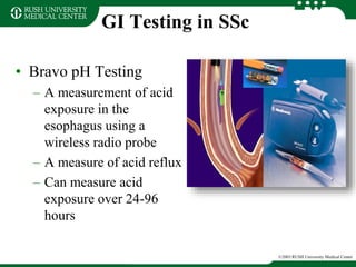 GI Testing in SSc
• Bravo pH Testing
– A measurement of acid
exposure in the
esophagus using a
wireless radio probe
– A measure of acid reflux
– Can measure acid
exposure over 24-96
hours
©2003 RUSH University Medical Center
 