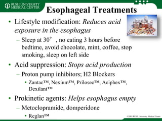 Esophageal Treatments
• Lifestyle modification: Reduces acid
exposure in the esophagus
– Sleep at 30°, no eating 3 hours before
bedtime, avoid chocolate, mint, coffee, stop
smoking, sleep on left side
• Acid suppression: Stops acid production
– Proton pump inhibitors; H2 Blockers
• Zantac™, Nexium™, Prilosec™, Aciphex™,
Dexilant™
• Prokinetic agents: Helps esophagus empty
– Metoclopramide, domperidone
• Reglan™ ©2003 RUSH University Medical Center
 