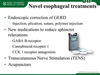 Novel esophageal treatments
• Endoscopic correction of GERD
– Injection, plication, suture, polymer injection
• New medications to reduce sphincter
relaxations
– GABA B-receptor
– Cannabinoid receptor 1
– CCK 1 receptor antagonists
• Transcutaneous Nerve Stimulation (TENS)
• Acupuncture
©2003 RUSH University Medical Center
 