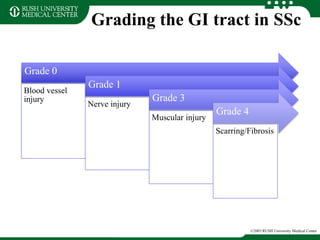 Grading the GI tract in SSc
©2003 RUSH University Medical Center
Grade 0
Blood vessel
injury
Grade 1
Nerve injury
Grade 3
Muscular injury
Grade 4
Scarring/Fibrosis
 
