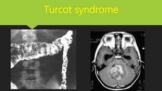 Turcot syndrome
 