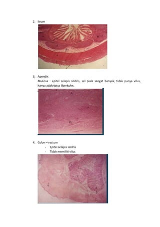 2. Ileum 
3. Apendix 
Mukosa : epitel selapis silidris, sel piala sangat banyak, tidak punya vilus, 
hanya adakriptus liberkuhn. 
4. Colon – rectum 
- Epitel selapis silidris 
- Tidak memiliki vilus 
 