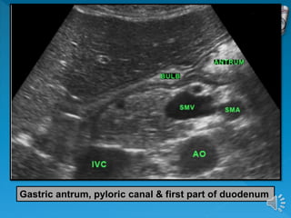 Gastric antrum, pyloric canal & first part of duodenum
 