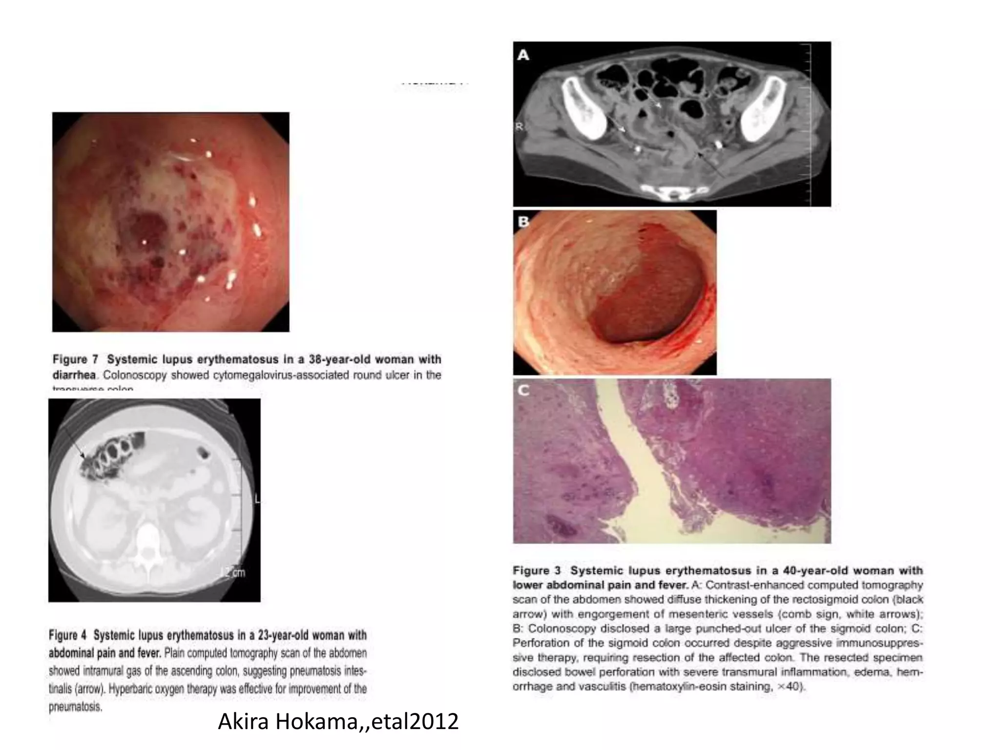Akira Hokama,,etal2012
 