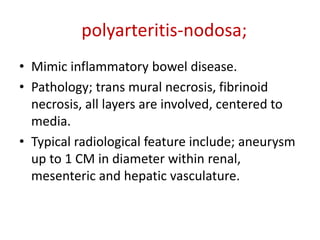 • Mimic inflammatory bowel disease.
• Pathology; trans mural necrosis, fibrinoid
necrosis, all layers are involved, centered to
media.
• Typical radiological feature include; aneurysm
up to 1 CM in diameter within renal,
mesenteric and hepatic vasculature.
polyarteritis-nodosa;
 