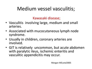 Medium vessel vasculitis;
Kawasaki disease;
• Vasculitis involving large, medium and small
arteries.
• Associated with mucocutaneous lymph node
syndrome.
• Usually in children, coronary arteries are
involved.
• GIT is relatively uncommon, but acute abdomen
with paralytic ileus, ischemic enteritis and
vasculitic appendicitis may occur.
Morgan MD,etal2005
 