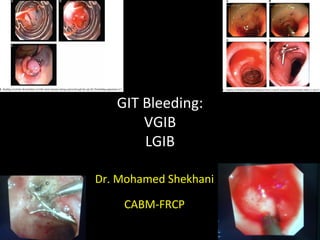 GIT Bleeding: VGIB LGIB Dr. Mohamed Shekhani CABM-FRCP 