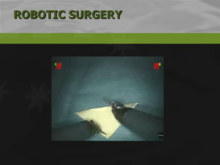 ROBOTIC SURGERY 