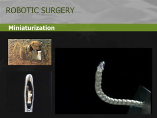 Miniaturization ROBOTIC SURGERY 