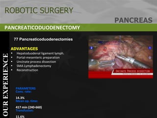 ADVANTAGES Hepatoduodenal ligament lymph. Portal-mesenteric preparation Uncinate process dissection SMA Lymphadenectomy Reconstruction PARAMETERS Conv. rate:   14.3%  Mean op. time:   417 min (240-660)   Transfusion:   11.6% Mortality:  3.8% Morbidity:   34%   Lenght of stay:   Italy 15 day, US  10 days  OUR EXPERIENCE ROBOTIC SURGERY PANCREAS PANCREATICODUODENECTOMY 77 Pancreaticoduodenectomies   