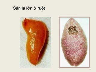 Bài giảng kí sinh trùng phần giun sán y2 | PPTX
