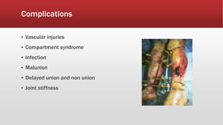 Complications
▪ Vascular injuries
▪ Compartment syndrome
▪ Infection
▪ Malunion
▪ Delayed union and non union
▪ Joint stiffness
 