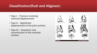 Classification(Rudi and Allgower)
▪ Type I – Fracture involving
minimal displacement
▪ Type II – Significant
displacement of the joint surface
▪ Type III – Impaction and
comminution of the articular
surface
 