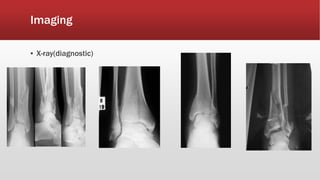 Imaging
▪ X-ray(diagnostic)
 
