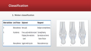 Classification
1. Weber classification
 