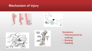 Mechanism of injury
Symptoms
• Pain(worsened by
walking)
• Bruising
• Swelling
 