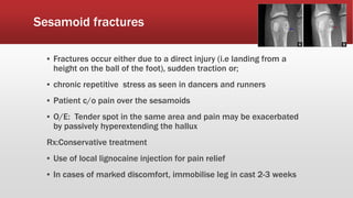 Sesamoid fractures
▪ Fractures occur either due to a direct injury (i.e landing from a
height on the ball of the foot), sudden traction or;
▪ chronic repetitive stress as seen in dancers and runners
▪ Patient c/o pain over the sesamoids
▪ O/E: Tender spot in the same area and pain may be exacerbated
by passively hyperextending the hallux
Rx:Conservative treatment
▪ Use of local lignocaine injection for pain relief
▪ In cases of marked discomfort, immobilise leg in cast 2-3 weeks
 
