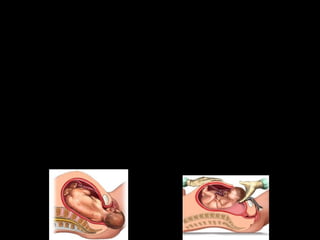 ERDITZEA
Umetokiko horman kontrakzioak hasten
dira eta zaku anmiotikoa puskatu egiten da.
Umea baginatik edo zesarea bidez
ateratzen da.
Kanpoan dagoenean birikak
funtzionatzen hasten dira eta zilbor hestea
moztu egiten da.

 