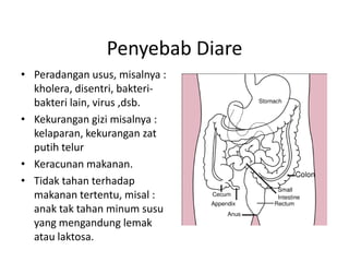 Penyebab Diare
• Peradangan usus, misalnya :
kholera, disentri, bakteri-
bakteri lain, virus ,dsb.
• Kekurangan gizi misalnya :
kelaparan, kekurangan zat
putih telur
• Keracunan makanan.
• Tidak tahan terhadap
makanan tertentu, misal :
anak tak tahan minum susu
yang mengandung lemak
atau laktosa.
 