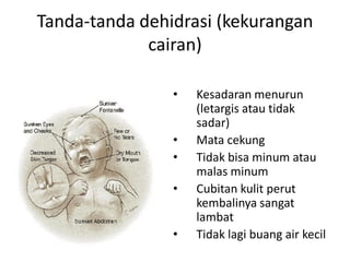 Tanda-tanda dehidrasi (kekurangan
cairan)
• Kesadaran menurun
(letargis atau tidak
sadar)
• Mata cekung
• Tidak bisa minum atau
malas minum
• Cubitan kulit perut
kembalinya sangat
lambat
• Tidak lagi buang air kecil
 