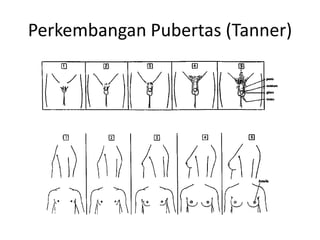 Perkembangan Pubertas (Tanner)
 