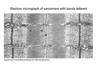 Electron micrograph of sarcomere with bands lettered 
 