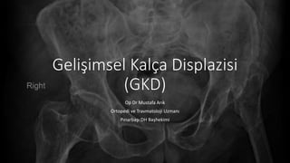 Gelişimsel Kalça Displazisi
(GKD)
Op Dr Mustafa Arık
Ortopedi ve Travmatoloji Uzmanı
Pınarbaşı DH Başhekimi
 